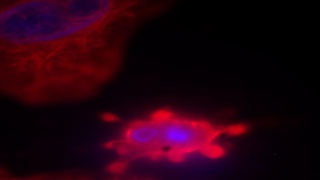 The molecular basis of breast cancer metastasis to the brain